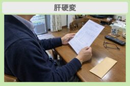 肝硬変 60代男性のイメージ（AI生成・患者本人ではありません）
