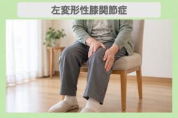 左変形性膝関節症：左膝に手を添える70代女性のイメージ（AI生成・患者本人ではありません）