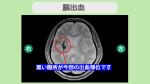 fe8edba85cc83c56db9bc9df08c94a686f561e6ce8e7ada115cdbe2ec50b5a24