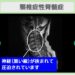 頚髄症性脊髄症　幹細胞治療