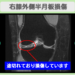 半月板損傷