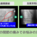 左変形性股関節症・左変形性膝関節症