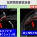 右肩腱板損傷