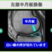 左膝半月板損傷