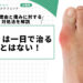 痛風は一日で治ることはない!その理由と痛みに対する対処法を解説