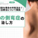 大人の側弯症の治し方｜症状が軽度な場合の対処法は？有効な治療法について解説