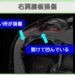 右肩腱板損傷