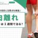 肉離れ（軽度）は1週間で治る？回復の目安と注意点を解説