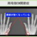両母指CM関節症