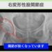股関節(OA)の症例 大阪院-647