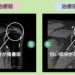 左肩腱板損傷の症例 大阪院-258