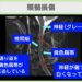 頚髄損傷のMRI所見